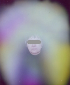 Proband_3_vorher
